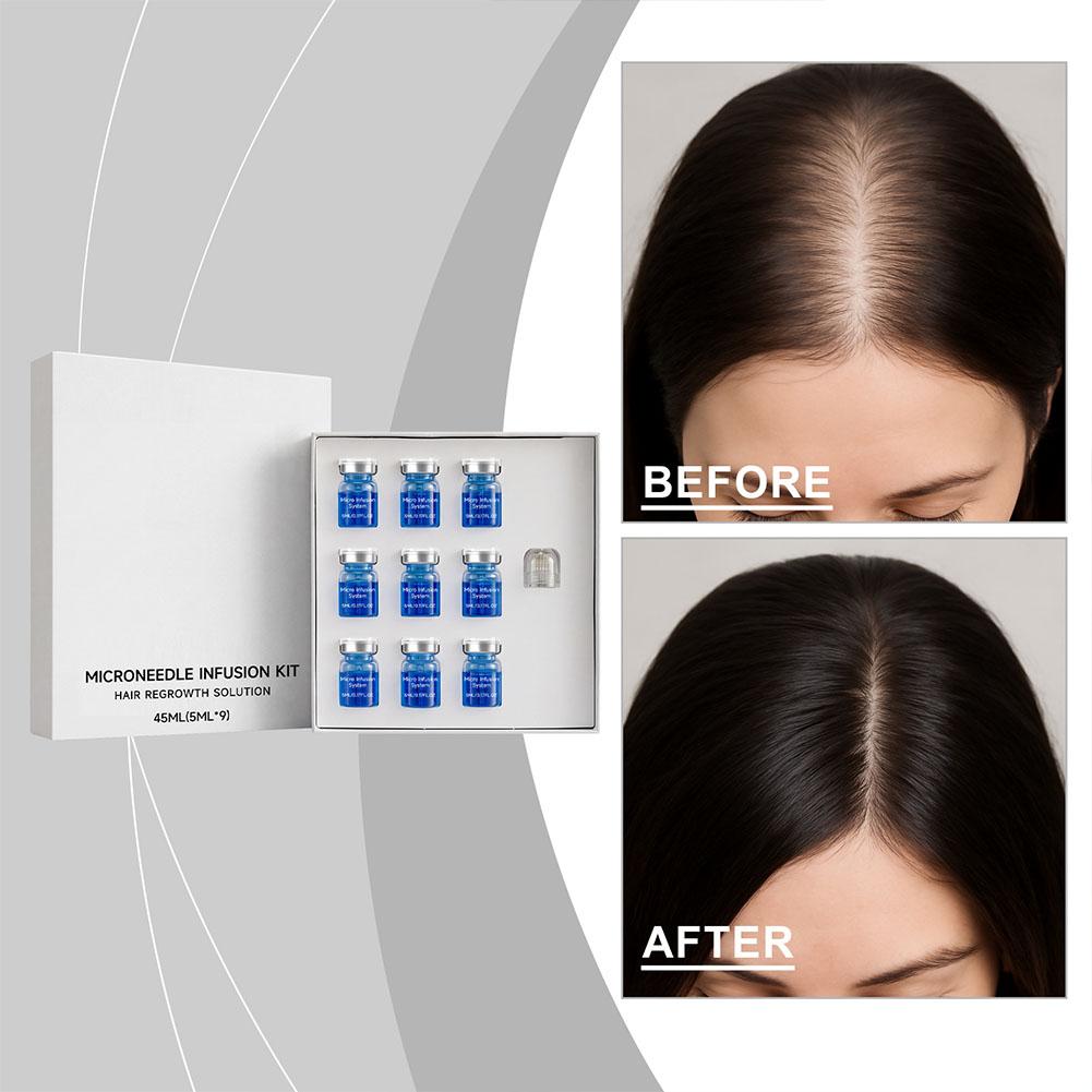 0.25mm Hair Essential Serum Mi - Derma Roller 0.25 recension och pris